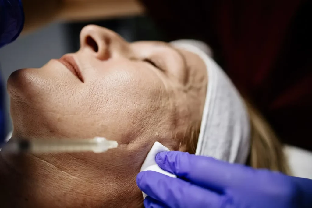 zabieg z wykorzystaniem osocza bogatopłytkowego